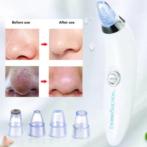 Derma Suction Blackhead, Acne, Oil Remover - Sleek Shopping